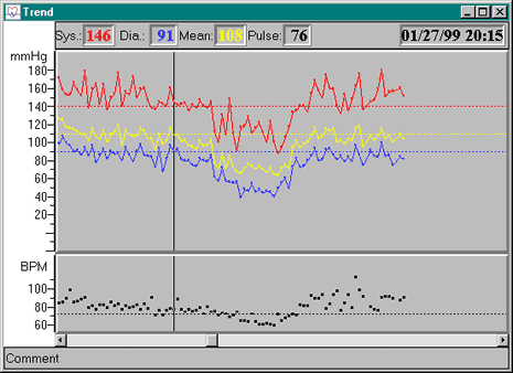 Trend Graph